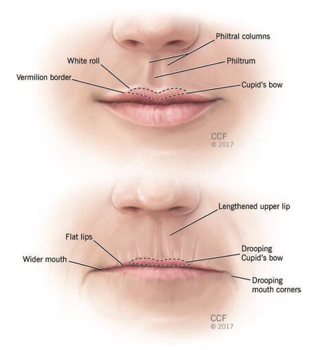 Modificações etárias da região labial e perilabial